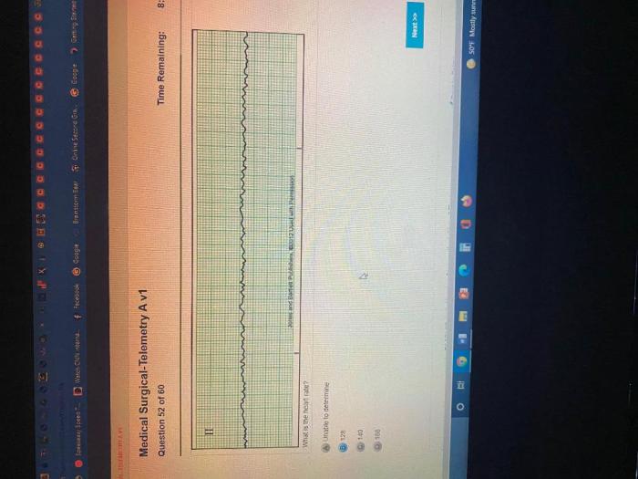 Relias progressive care rn b v1 answers